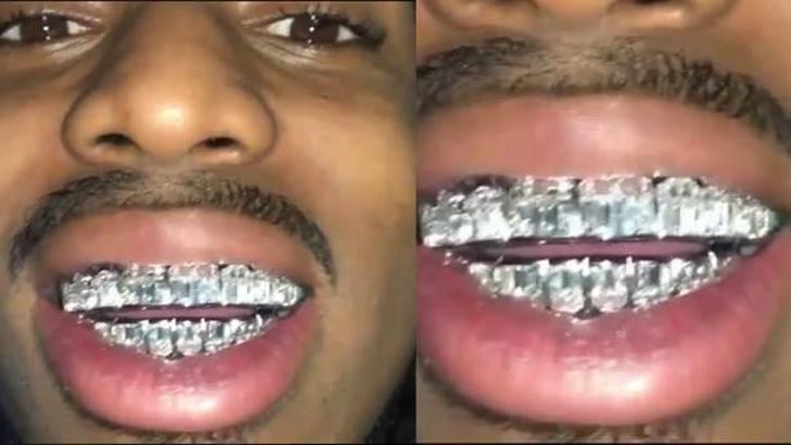 Dişlerine 250 bin dolar harcayan altın dişli rapçi Quavo, fıldır fıldır yürüyor