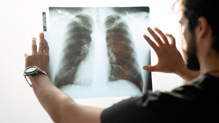 Rüyada Röntgen Görmek Ne Demek? Röntgen Çektirdiğini Görmek