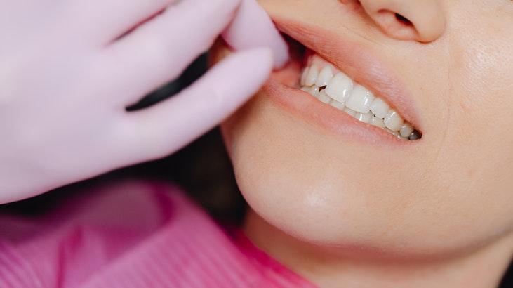 Rüyada Alt Dişlerin Dökülmesi Ne Anlama Gelir? Ne Demek, Neye