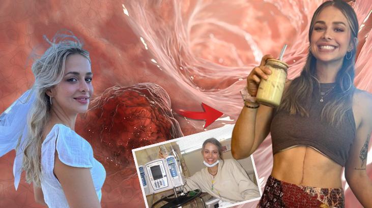 Aylarca erteledi, canından olacaktı! Peş peşe 10 kez geğirince hayatı kurtuldu