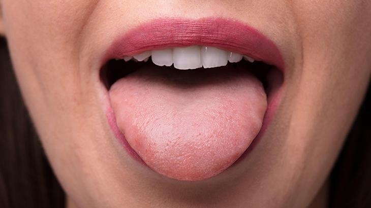Arkasında bu nedenler var! Dilinizin beyazlaşmasını engelleyecek 8 doğal yöntem