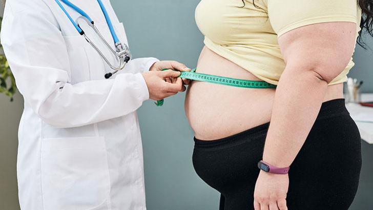 Kronik bir hastalık! ‘Binden fazla gen varyantı obezite ile ilişkilendiriliyor’