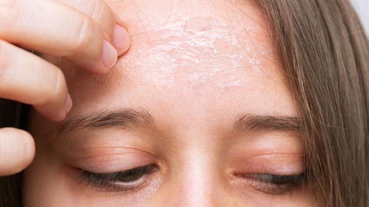 Serinleyeyim derken sağlığınızdan olmayın! Klimaların kuruttuğu cilde dikkat
