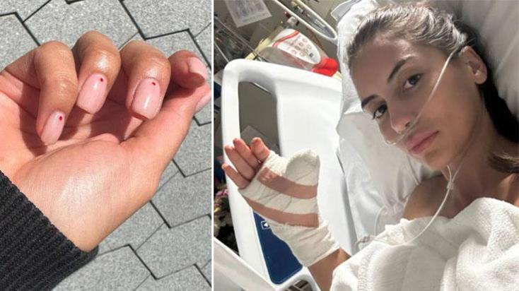 Manikür için gitti, 6 ameliyat geçirdi! 'Bu malzemelere dikkat edin'