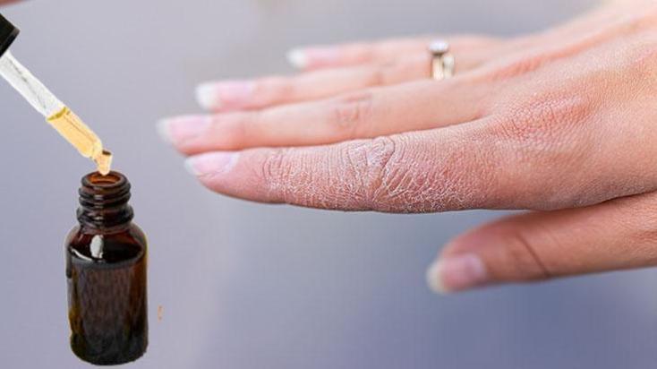 Eldeki çatlakları bir gecede pamuk gibi yapıyor! Cilt üzerinde bariyer etkisi