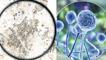 Mantar kâbusu! Akciğerleri tüketen Aspergillus küresel ısınmayla yayılıyor