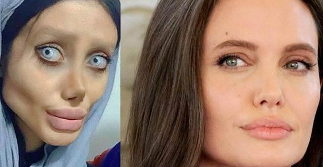 Tek istediği Angelina Jolie'ye benzemekti