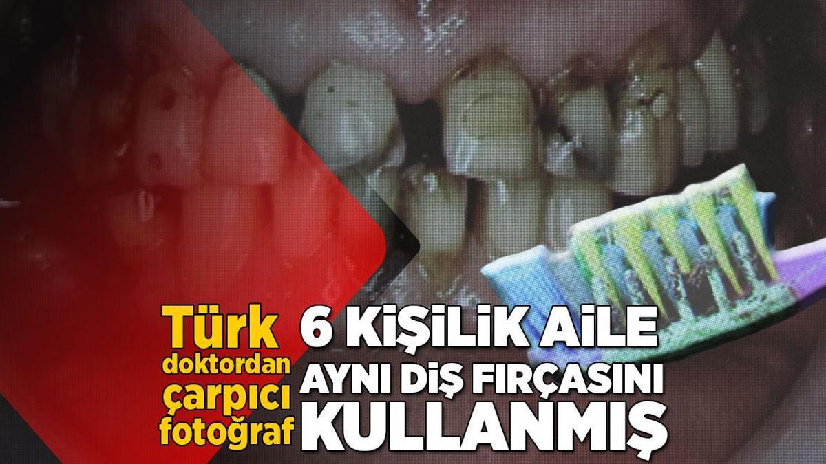 İlginç Haberler: 6 kişilik aile aynı diş fırçasını kullandı! Çarpıcı fotoğraf ortaya çıktı