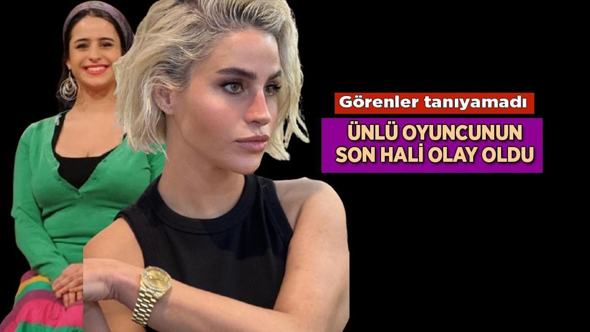 Haberler: Yıllar içinde olduğu estetik ameliyatlarla bambaşka biri oldu! İşte Büşra Pekin'in son hali