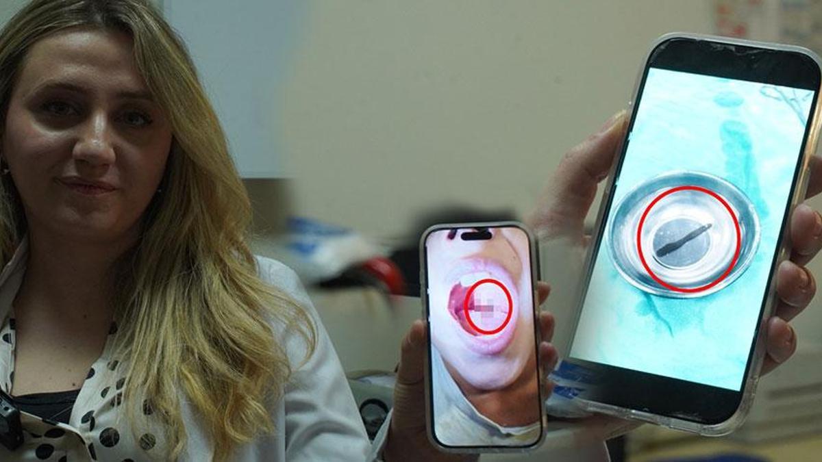 Doktor muayenede fark etti! 10 yaşındaki çocuğun boğazından canlı sülük çıktı