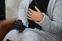 Biyonik kolu yüzünü güldürdü