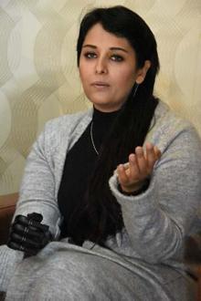 Biyonik kolu yüzünü güldürdü