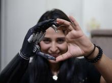 Yaşadıkları yıldırmadı, Revoyla hayata tutundu