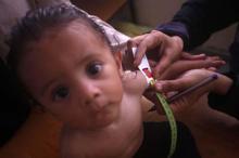 Gazzede sessiz çığlık: Bebekler açlıktan ölüme sürükleniyor