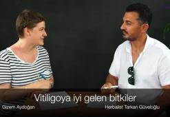 Vitiligoya iyi gelen bitkiler neler?