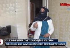 Kadın kılığına giren üvey kardeşi tarafından döner bıçağıyla yaralandı
