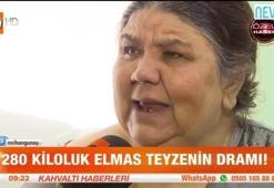 280 kiloluk fil hastası Elmas teyzenin dramı!