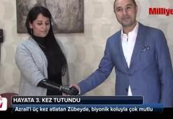 Biyonik kolu yüzünü güldürdü