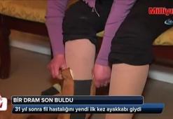 Fil hastası kadın 31 yıl sonra ayakkabı giydi