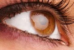 Göz altı torbaları çok şeyin habercisi!