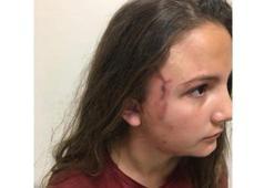 Çocuk parkında dehşet! 12 yaşındaki kızı 6 kişi zor kurtardı