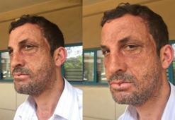 "Saçım 25, sakalım 39 yaşında"