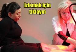 31 yıl sonra fil hastalığını yendi