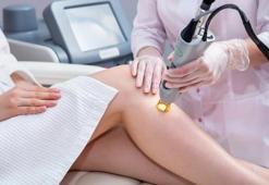 Lazer epilasyon zararlı mı?