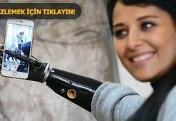 Biyonik kolu yüzünü güldürdü