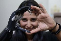 Yaşadıkları yıldırmadı, 'Revo'yla hayata tutundu