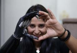 Yaşadıkları yıldırmadı, 'Revo'yla hayata tutundu