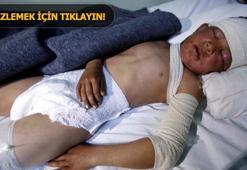Son dakika: IŞİD ilk kez kimyasal silahla saldırdı! Havan topuyla fırlattılar...