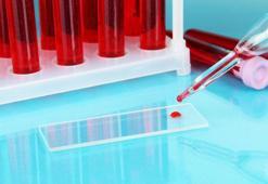 Kan grubuna göre diyet nasıl yapılır?