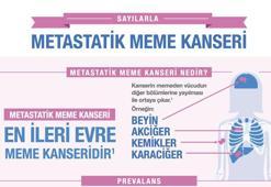 Meme kanserinde kişiye özel tedavi!