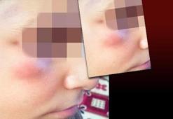 Okul müdürünün 'empatili' dayak savunması!