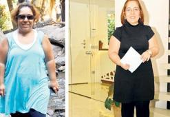 Lipödem kadınların kâbusu haline geldi