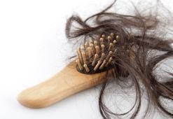 Saç dökülmesi nasıl engellenir?