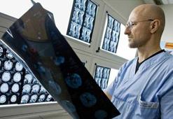 Başarılı bir insan kafası nakli asla yapılamadı ve yapılamayacak!