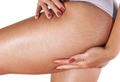 Çatlak izlerini azaltan yöntem