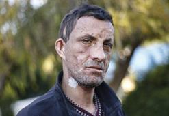 Türkiye için bir ilk gerçekleşmişti! İşte 7 yıl sonraki görüntüsü...