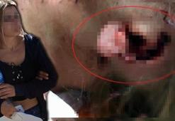 Samsun'da akıllara zarar olay! Isırarak kopardı...