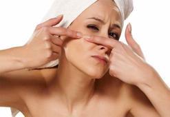 Sivilce şişliği nasıl geçer?