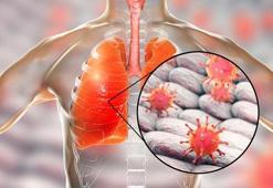 H1N1 virüsü nedir?