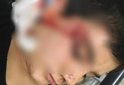 Köpeğin ağzından zor aldılar