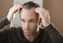 Saç dökülmesinin tedavisi mümkün mü?