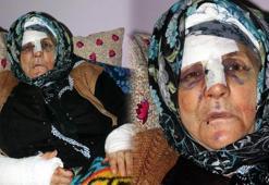 Her satırı dehşet! Yaşlı kadını bu hale soktu