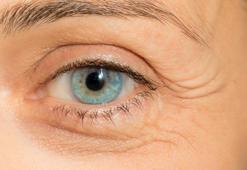 Astigmat ve hipermetrop göz çevresini kırıştırıyor