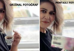 Tüp mide ameliyatıyla zayıfladı! Fotoğrafını ilaç firması kullandı