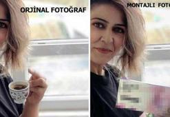 Tüp mide ameliyatıyla zayıfladı! Fotoğrafını ilaç firması kullandı