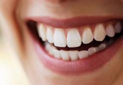 Dişe lamina uygulamaları ile ilgili merak edilenler